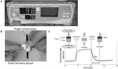 Supervised Machine Learning Applied to Automate Flash and Prolonged Capillary Refill Detection by Pulse Oximetry